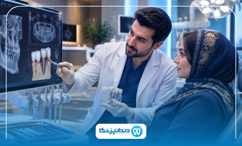 نقش تراکم استخوان فک در موفقیت ایمپلنت