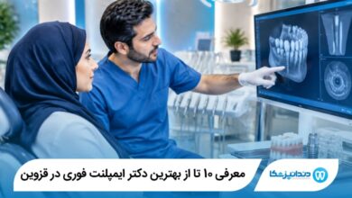 بهترین دکتر ایمپلنت فوری در قزوین