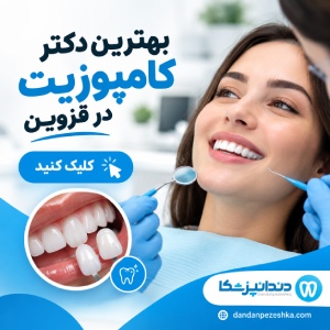 بهترین دکتر کامپوزیت در قزوین