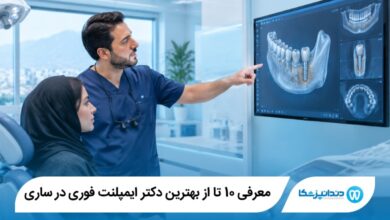 بهترین دکتر ایمپلنت فوری در ساری
