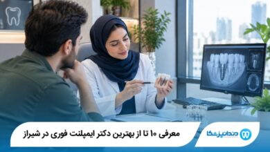 بهترین دکتر ایمپلنت فوری در شیراز