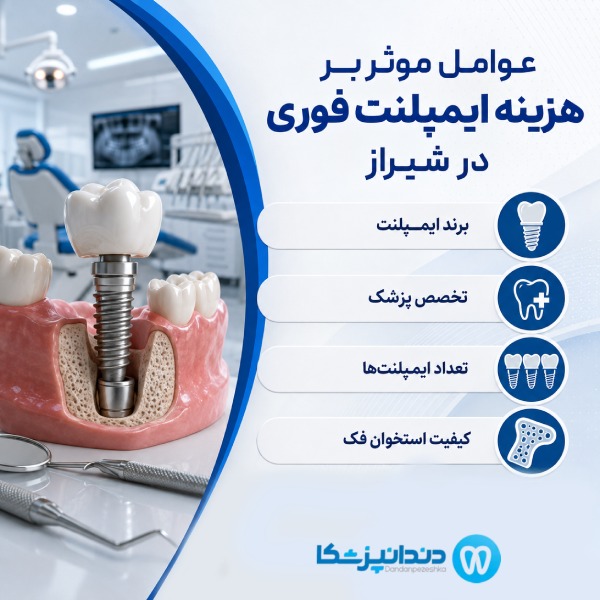 عوامل موثر بر هزینه ایمپلنت فوری در شیراز