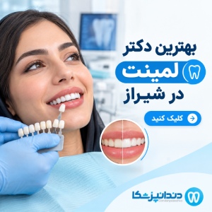 بهترین دکتر لمینت در شیراز