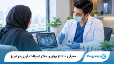 بهترین دکتر ایمپلنت فوری در تبریز
