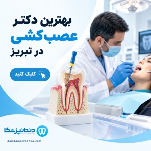 بهترین دکتر عصب کشی در تبریز