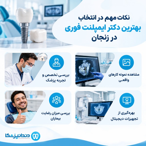نکات مهم در انتخاب بهترین دکتر ایمپلنت فوری در زنجان