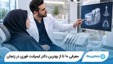 بهترین دکتر ایمپلنت فوری در زنجان