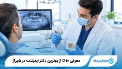 بهترین دکتر ایمپلنت در شیراز