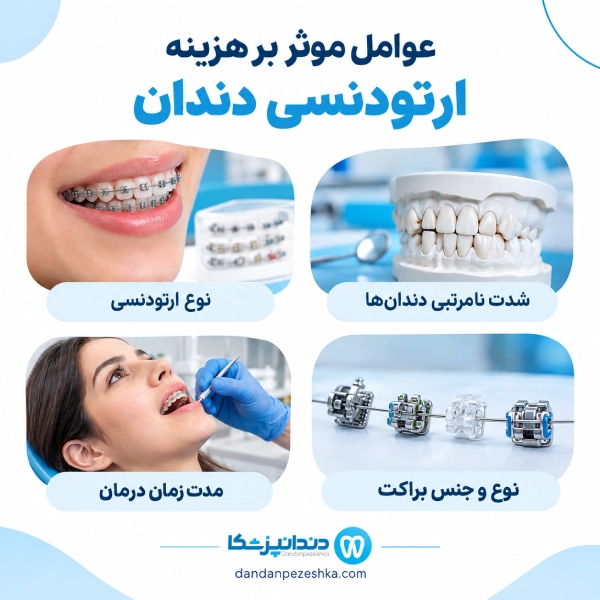 عوامل موثر بر هزینه ارتودنسی دندان