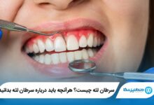 سرطان لثه چیست؟ هرآنچه باید درباره سرطان لثه بدانید
