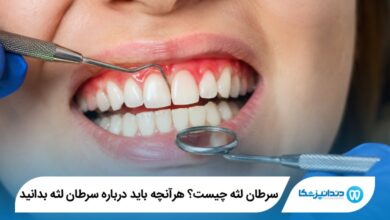 سرطان لثه چیست؟ هرآنچه باید درباره سرطان لثه بدانید
