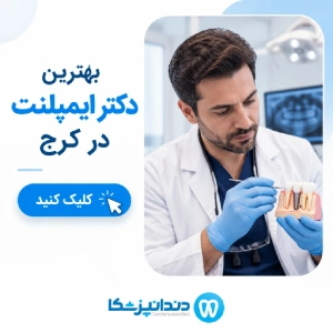 بهترین دکتر ایمپلنت در کرج